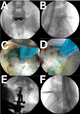 Figure 15