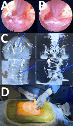 Figure 17