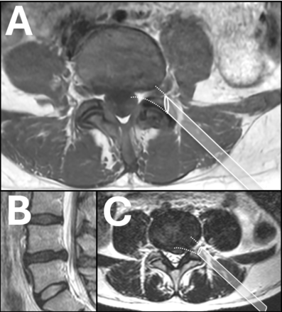 Figure 18