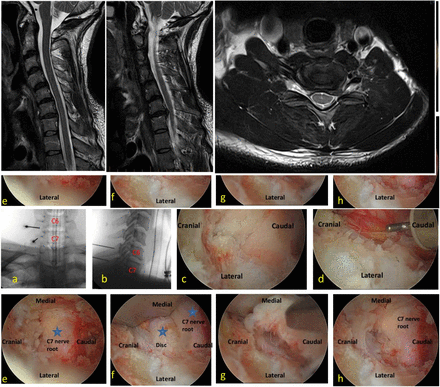 Figure 6