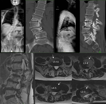 Figure 17