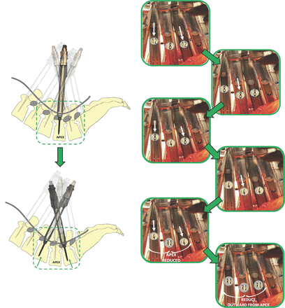 Figure 9