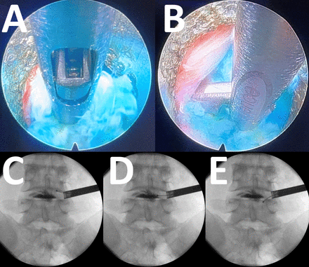 Figure 10