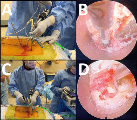 Figure 16